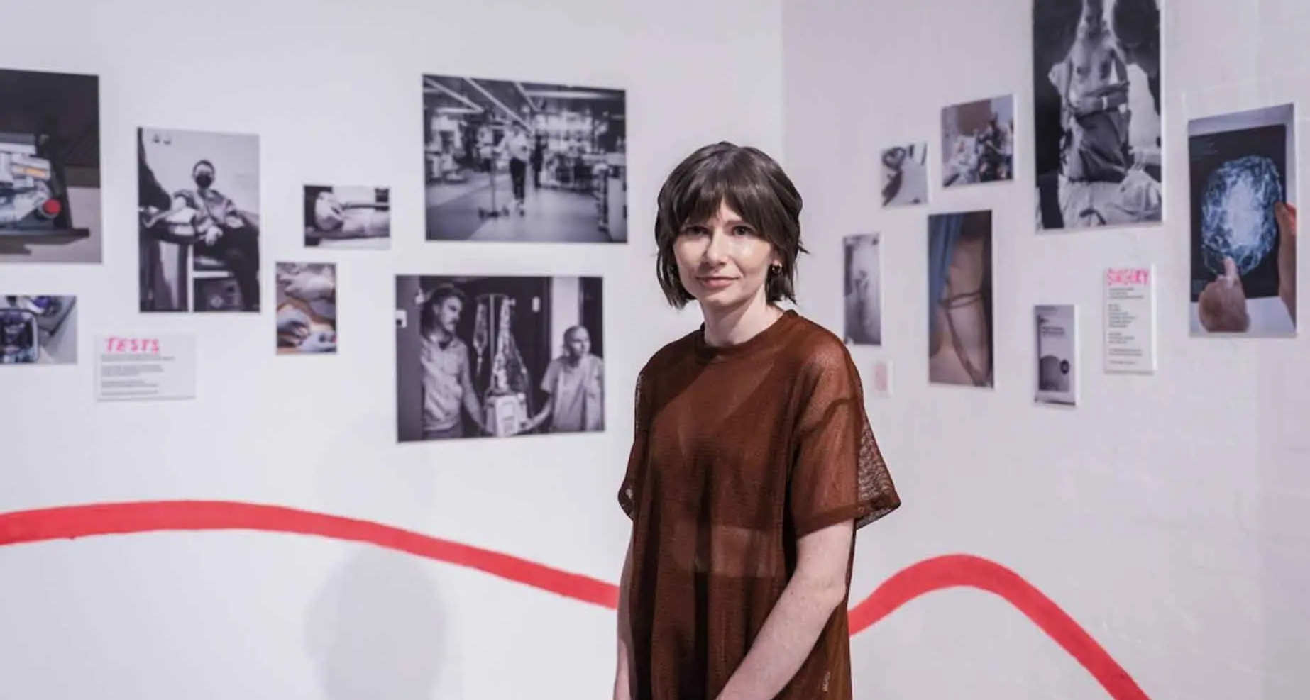 Hidden breast cancer costs increase burden of disease