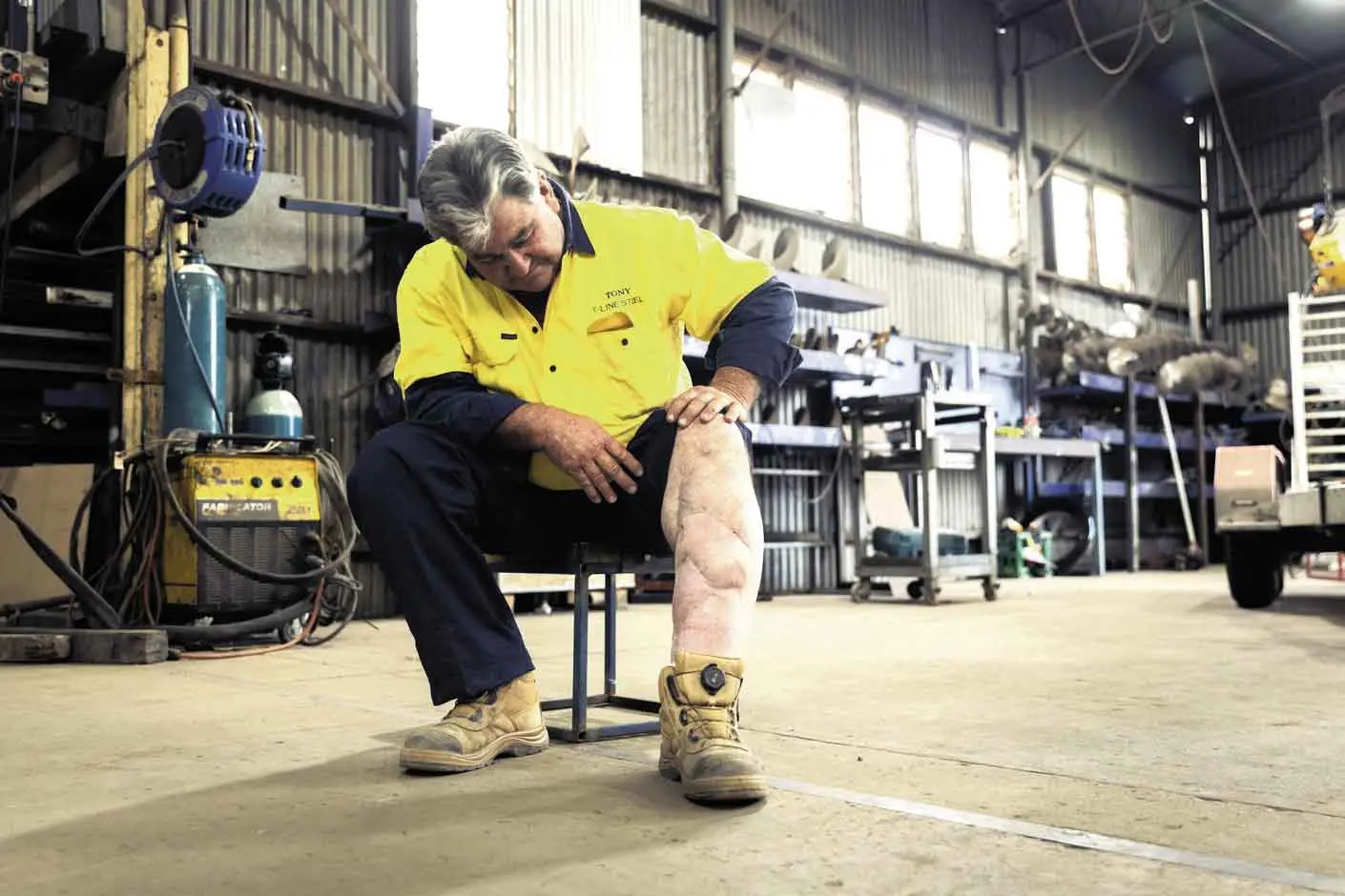<p>Tony survived a catastrophic injury to his legs and was transported to medical treatment by the RFDS. Photo: RFDS</p>\\n